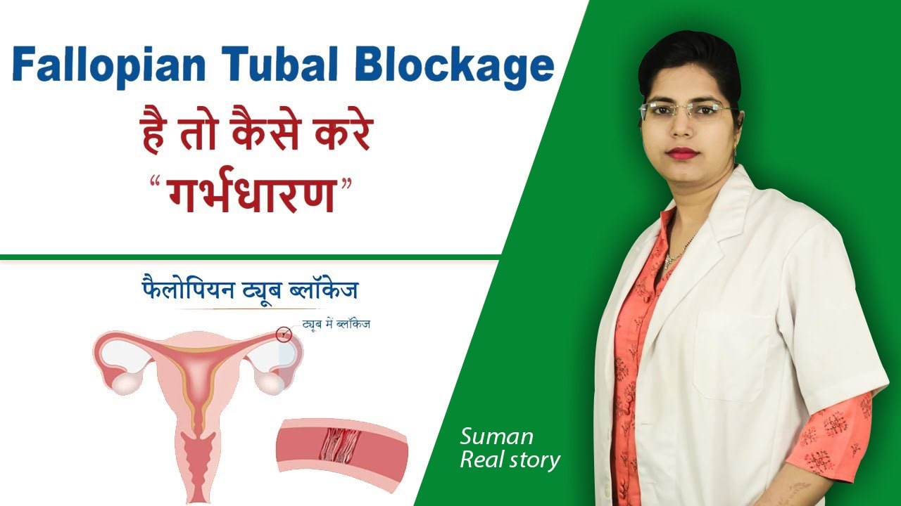 fallopian tubal blcokage treatment