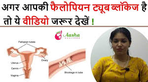 Fallopian Tube Blockage Treatment Without Surgery - Aasha Ayurveda