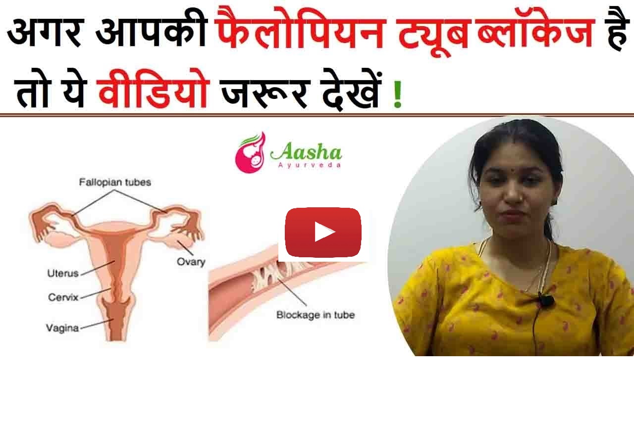 Blocked fallopian tube treatment without surgery 