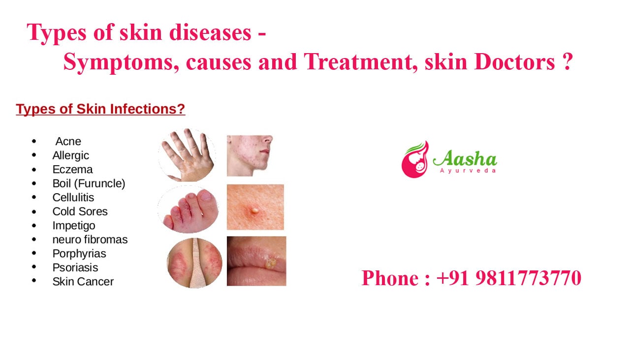 Types Of Skin Diseases Symptoms Causes And Treatment Skin Doctors