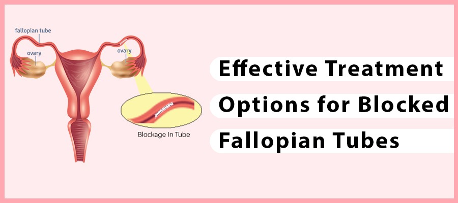 Blocked Fallopian Tubes Treatment - Aasha Ayurveda