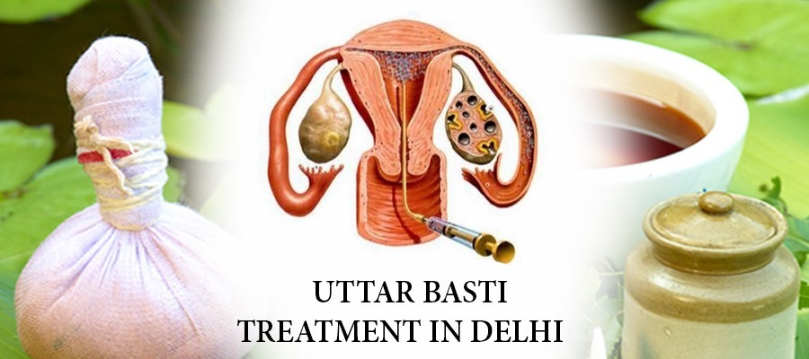 Uttar Basti treatment in Delhi | Mumbai | Lucknow | Pune