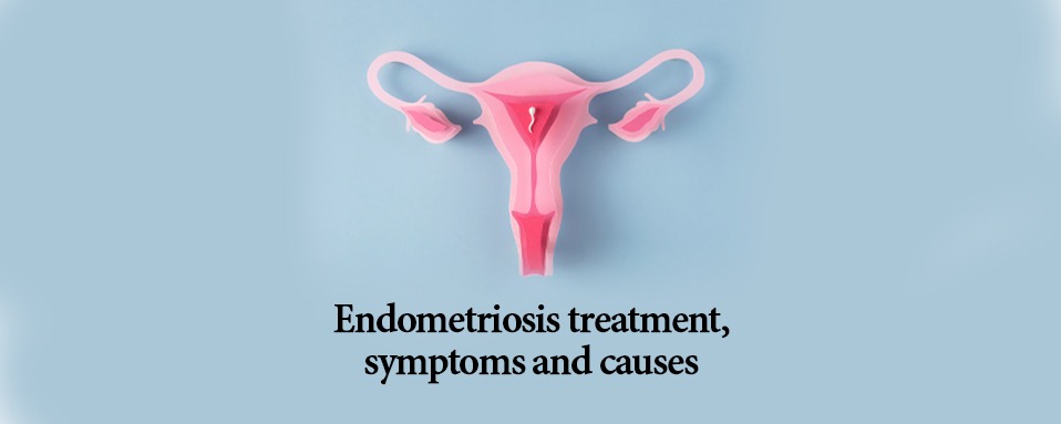 Adenomyosis Treatment in Ayurveda