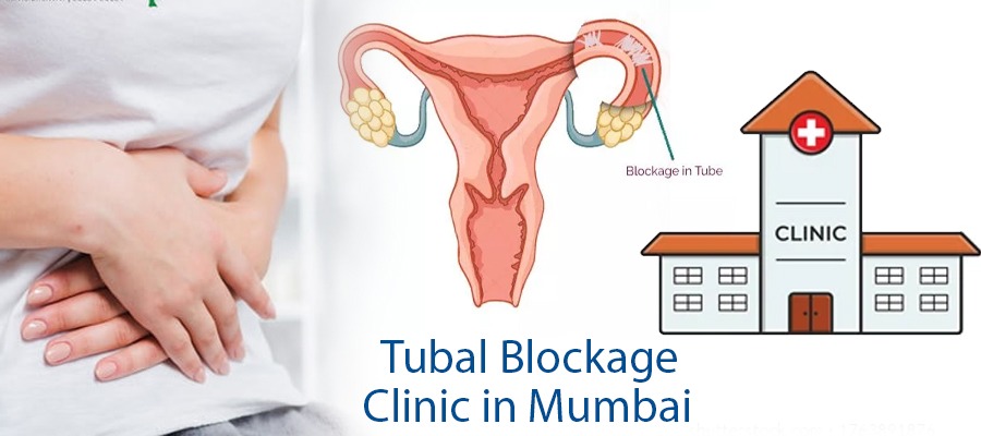 Fallopian Tube Blockage Treatment in Mumbai