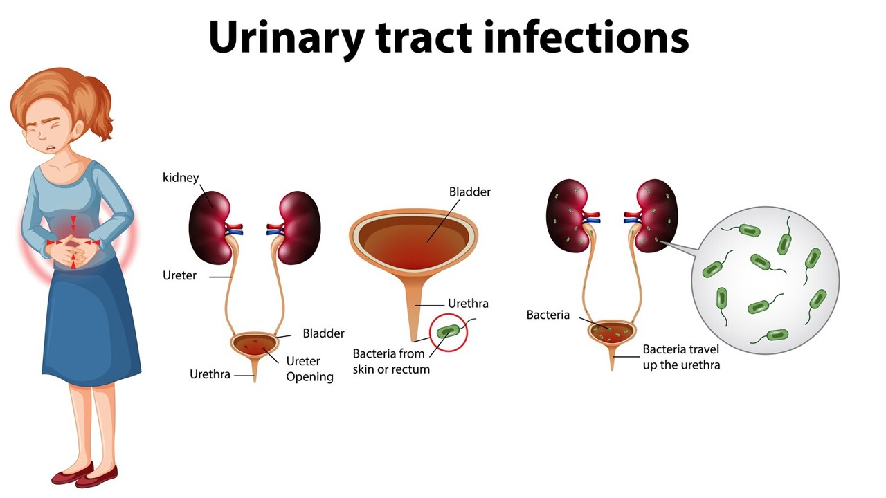 Ayurveda Treatment for Urinary Tract Infection in Male & Female