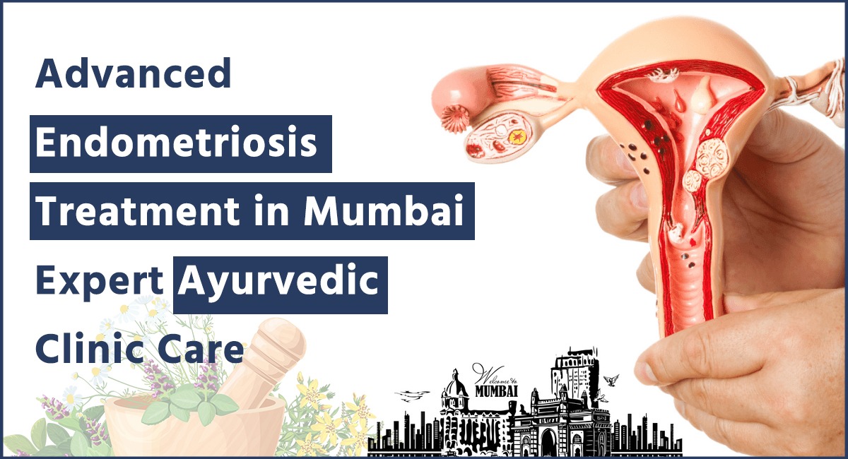 Advanced Endometriosis Treatment in Mumbai | Expert Ayurvedic Clinic Care