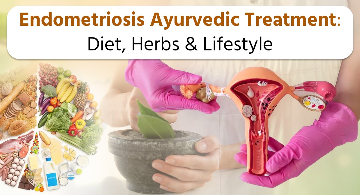 Endometriosis Ayurvedic Treatment: Diet, Herbs & Lifestyle