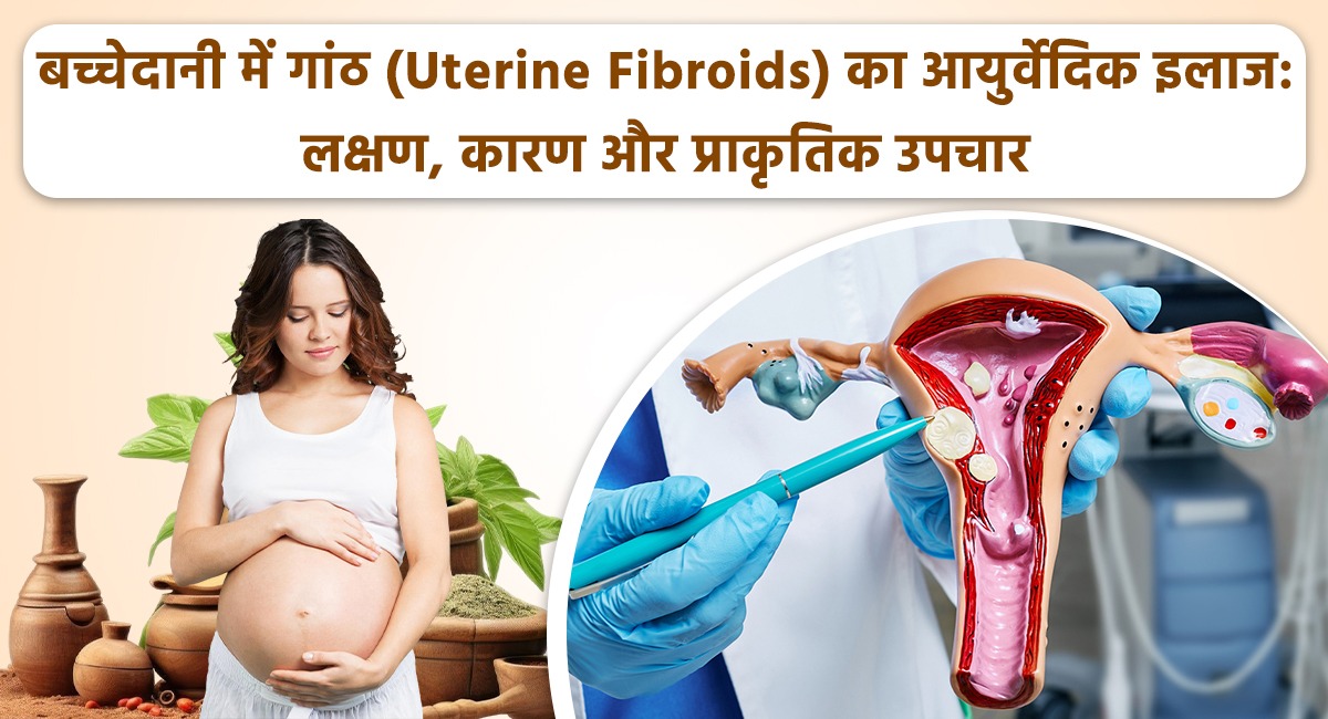बच्चेदानी में गांठ (Uterine Fibroids) का आयुर्वेदिक इलाज: लक्षण, कारण और प्राकृतिक उपचार