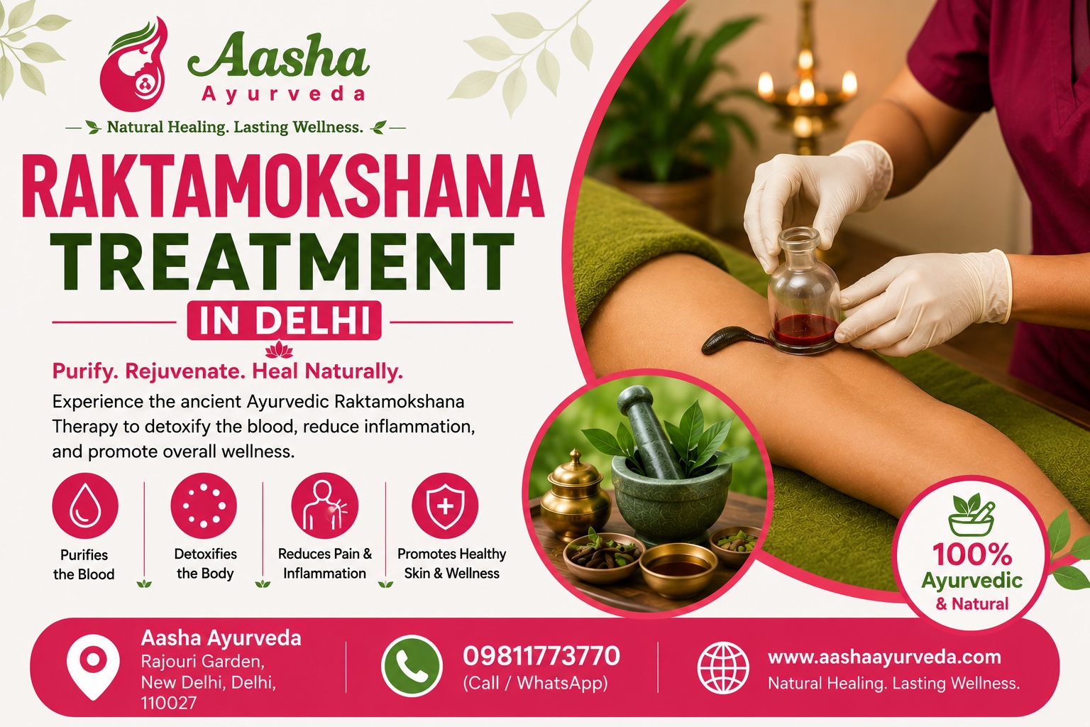 Raktamokshana Treatment in Delhi